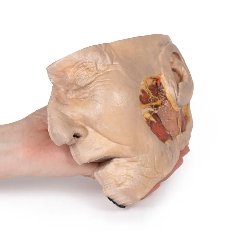 3D Printed Parotid Gland and Facial Nerve Dissection